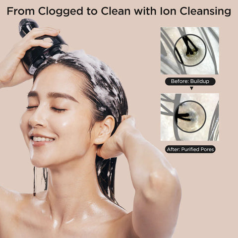 Mytrex Head Spa Deep X Masajeador facial y capilar con EMS que estimula el crecimiento del cabello
